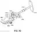 Fig. 77 - Ankle replacement system and method