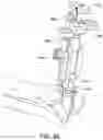 Fig. 79 - Ankle replacement system and method