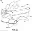 Fig. 81 - Ankle replacement system and method
