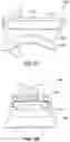 Fig. 82 - Ankle replacement system and method