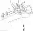 Fig. 85 - Ankle replacement system and method