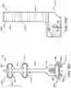 Fig. 86 - Ankle replacement system and method