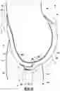 Fig. 06 - Incontinence treatment system and methods of use