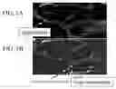 Fig. 02 - Skeletal muscle augmentation utilizing muscle-derived progenitor compositions, and treatments thereof