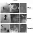 Fig. 13 - Immunoisolation device