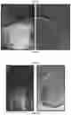 Fig. 17 - Immunoisolation device