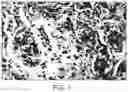 Fig. 02 - COMPOSITE CONTAINING COLLAGEN AND ELASTIN AS A DERMAL EXPANDER AND TISSUE FILLER