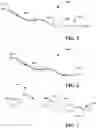 Fig. 04 - Nerve regeneration method