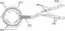 Fig. 01 - Simultaneous multi-site vagus nerve neuromodulation for improved glycemic control system and methods