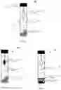 Fig. 02 - FECAL SAMPLE COLLECTION AND ANALYTE EXTRACTION DEVICE AND METHOD