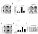 Fig. 04 - PEPTIDE FOR INHIBITING BONE RESORPTION