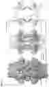 Fig. 02 - Transmembrane pore consisting of two CsgG pores