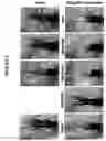 Fig. 04 - METHOD FOR TREATING POST-EMERGENT RICE