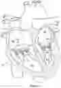 Fig. 06 - Native valve repair devices and procedures