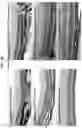 Fig. 34 - Methods and compositions for preventing or treating ophthalmic conditions