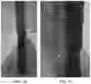 Fig. 03 - Distortion mitigation in directed energy deposition