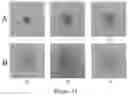 Fig. 13 - Devices, kits and methods for detecting misfolded proteins