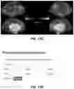Fig. 31 - Methods and tools for detecting, diagnosing, predicting, prognosticating, or treating a neurobehavioral phenotype in a subject