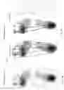 Fig. 04 - Method for design of insoles
