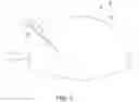 Fig. 04 - SURGICAL INSTRUMENT STABILIZATION DEVICE