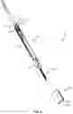 Fig. 09 - Surgical implant system and method