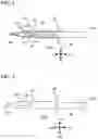 Fig. 02 - Intraocular lens injector