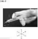 Fig. 05 - Intraocular lens injector