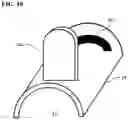 Fig. 10 - Intraocular lens injector