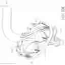 Fig. 43 - Valve replacement using moveable restraints and angled struts