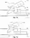 Fig. 08 - Medical device for cardiac valve implant