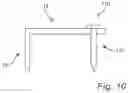 Fig. 07 - CONTINUOUS COMPRESSION FIXATION DEVICE FOR THE FUSION OF AN INTERCALARY STRUCTURAL AUGMENT