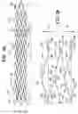 Fig. 02 - Stent with longitudinal variable width struts