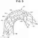 Fig. 06 - Stent with longitudinal variable width struts