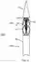 Fig. 09 - DELIVERY DEVICE AND DELIVERY SYSTEM FOR CONTROLLING RELEASE OF STENT IN A STEPWISE MANNER