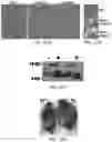 Fig. 07 - Methods for Improving Leptin Sensitivity for the Treatment of Obesity and Diabetes