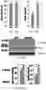 Fig. 10 - Methods for Improving Leptin Sensitivity for the Treatment of Obesity and Diabetes