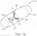 Fig. 05 - Method of delivering a somatostatin compound into a lumen of the intestinal tract using a swallowable drug delivery device