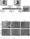 Fig. 02 - Pharmaceutical composition for prevention or treatment of preterm birth