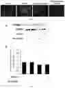 Fig. 07 - Pharmaceutical composition for prevention or treatment of preterm birth