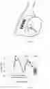 Fig. 31 - Glasses