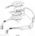 Fig. 37 - Glasses