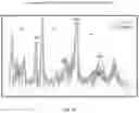 Fig. 22 - SYSTEMS AND METHODS OF ANALYZING AND INTERFACING WITH COMBINED IMAGING AND SPECTROSCOPY DATA FOR THE BRAIN