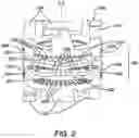 Fig. 03 - Catheter contact force sensor