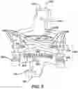 Fig. 04 - Catheter contact force sensor
