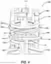 Fig. 05 - Catheter contact force sensor