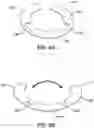 Fig. 07 - Catheter contact force sensor