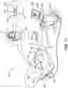 Fig. 12 - Catheter contact force sensor