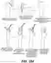 Fig. 85 - BONE RECONSTRUCTION AND ORTHOPEDIC IMPLANTS