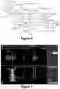 Fig. 08 - Augmented reality headset with varied opacity for navigated robotic surgery