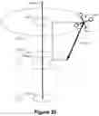 Fig. 22 - Augmented reality headset with varied opacity for navigated robotic surgery